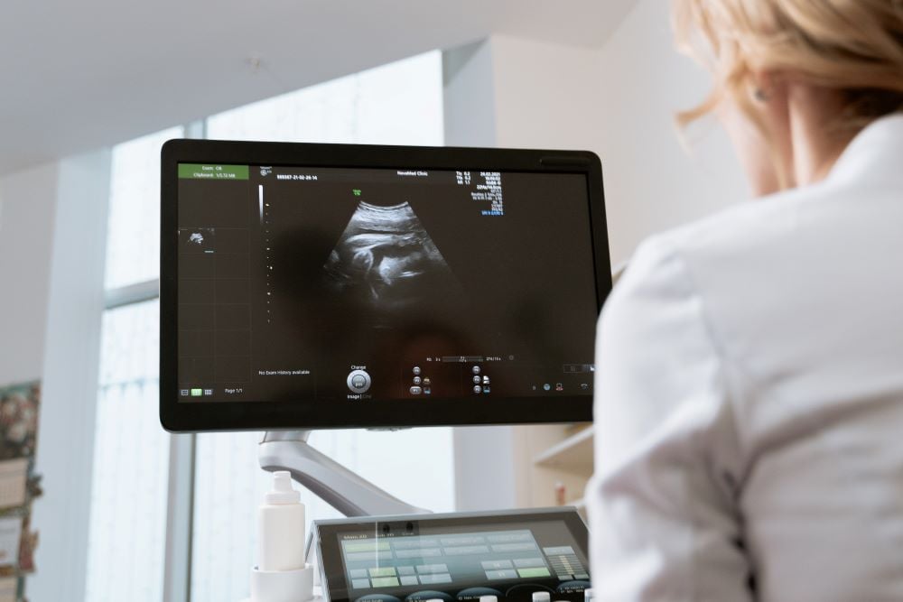 Excellent Opportunity for a Sonographer!